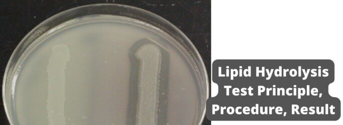 Lipid Hydrolysis Test Principle, Procedure, Result