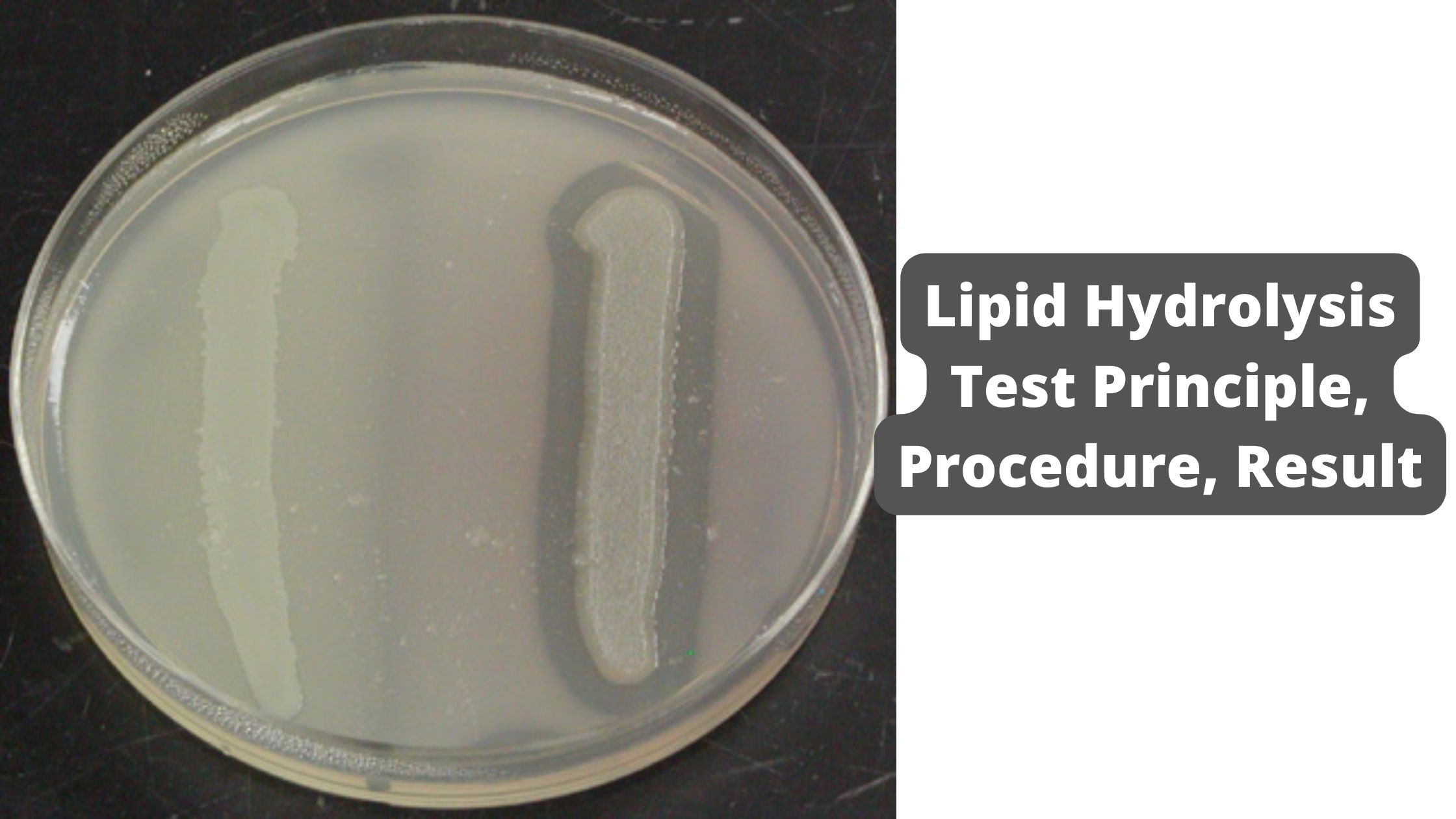 Lipid Hydrolysis Test Principle, Procedure, Result