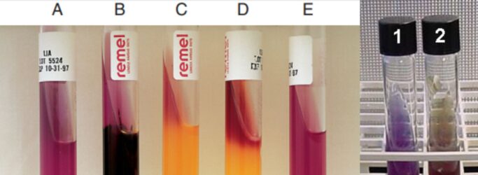 Lysine Iron Agar (LIA) Test Principle, Procedure, Result
