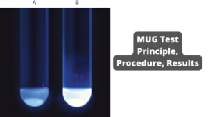 4-Methylumbelliferyl-b-d-Glucuronide (MUG) Test Principle, Procedure, Results