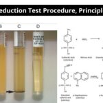 Nitrate Reduction Test Procedure, Principle, Result