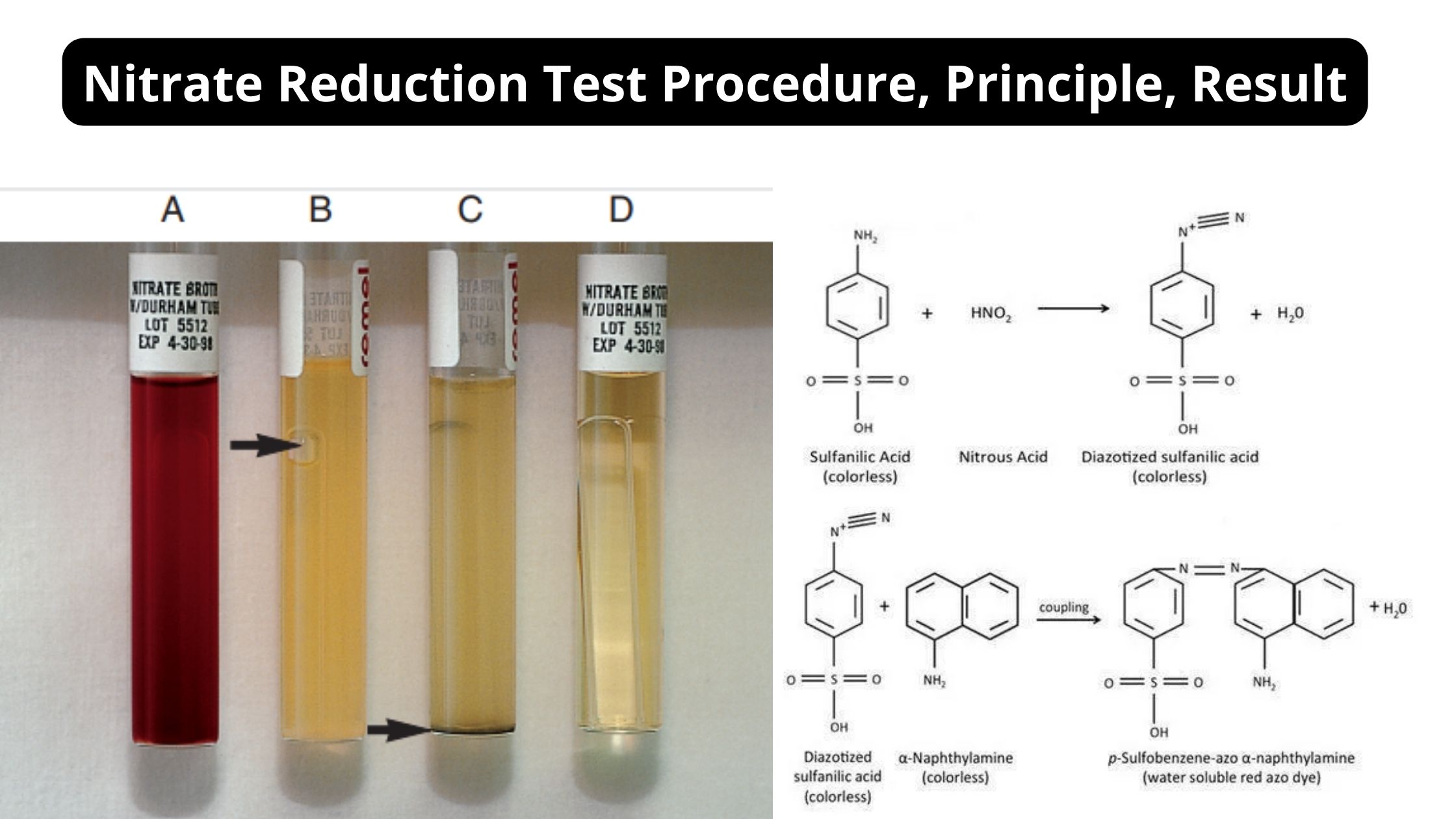 Nitrate Reduction Test Procedure, Principle, Result
