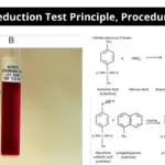 Nitrite Reduction Test Principle, Procedure, Result