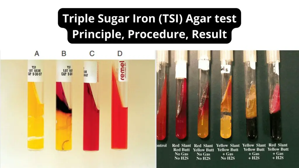 Triple Sugar Iron (TSI) Agar test Principle, Procedure, Result