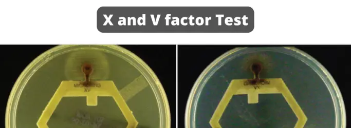X and V factor Test Principle, Purpose, Procedure, Result