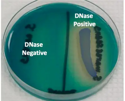 Result Interpretation Of Deoxyribonuclease (DNase) Test
