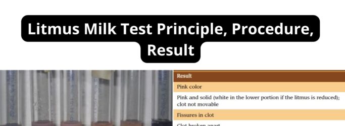 Litmus Milk Test Principle, Procedure, Result