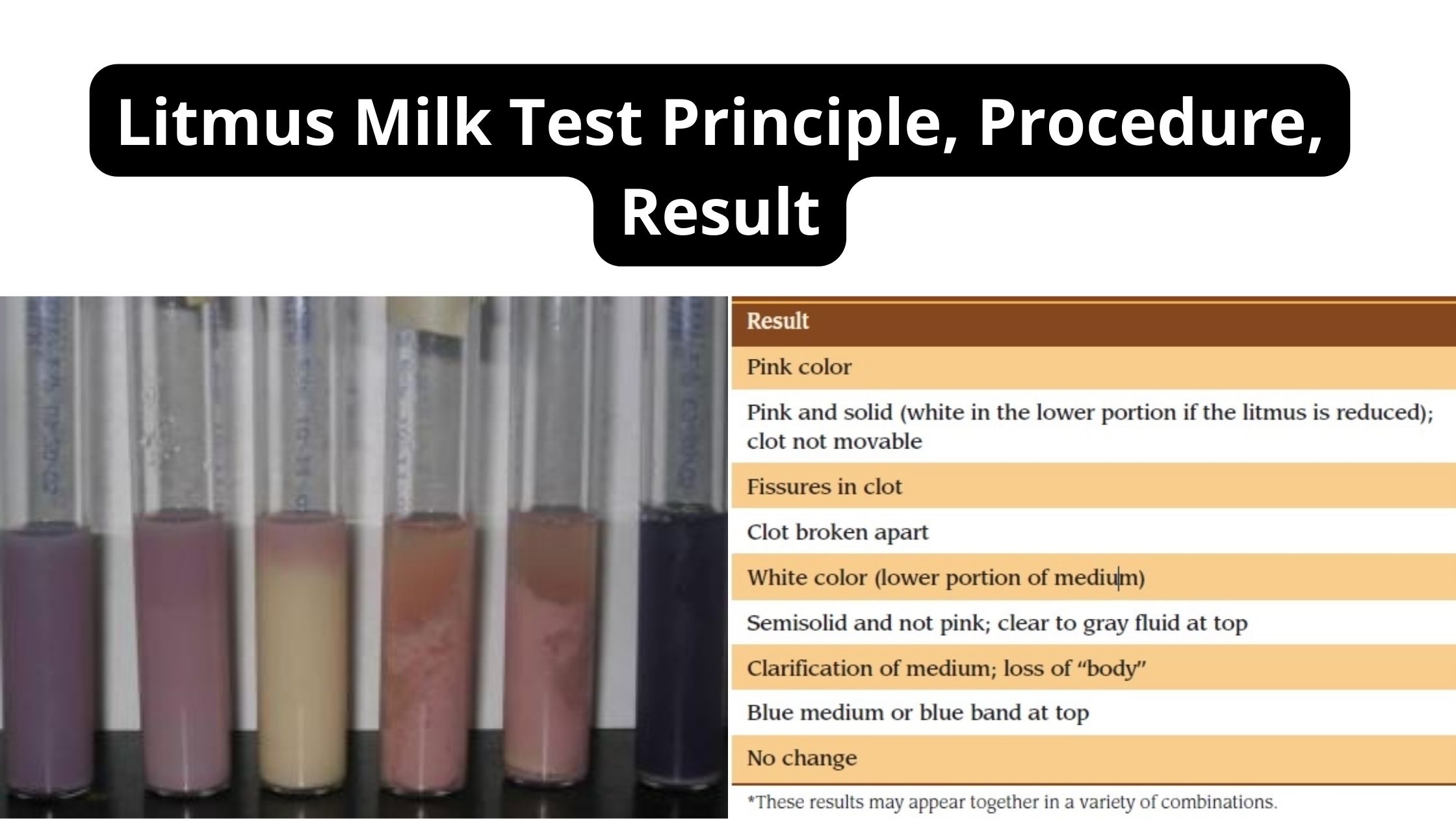 Litmus Milk Test Principle, Procedure, Result