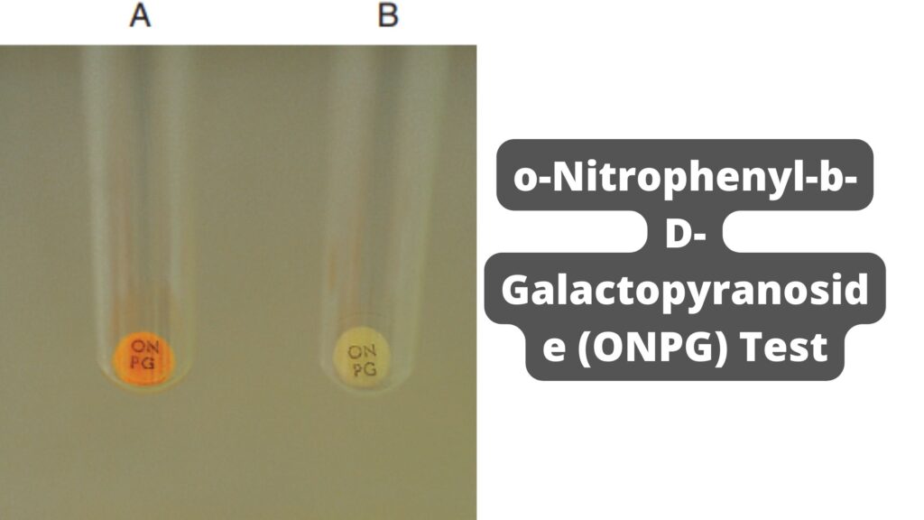o-Nitrophenyl-b-D-Galactopyranoside (ONPG) Test Principle, Procedure