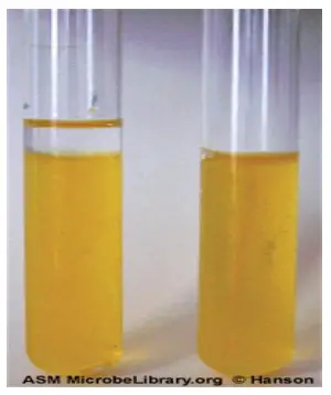 Interpretation and results of OF (Oxidation-Fermentation) Test