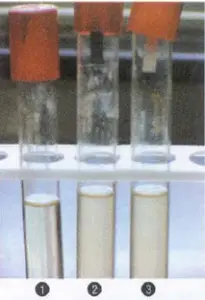 Result and Interpretation of Hydrogen Sulfide (H2S) Test
