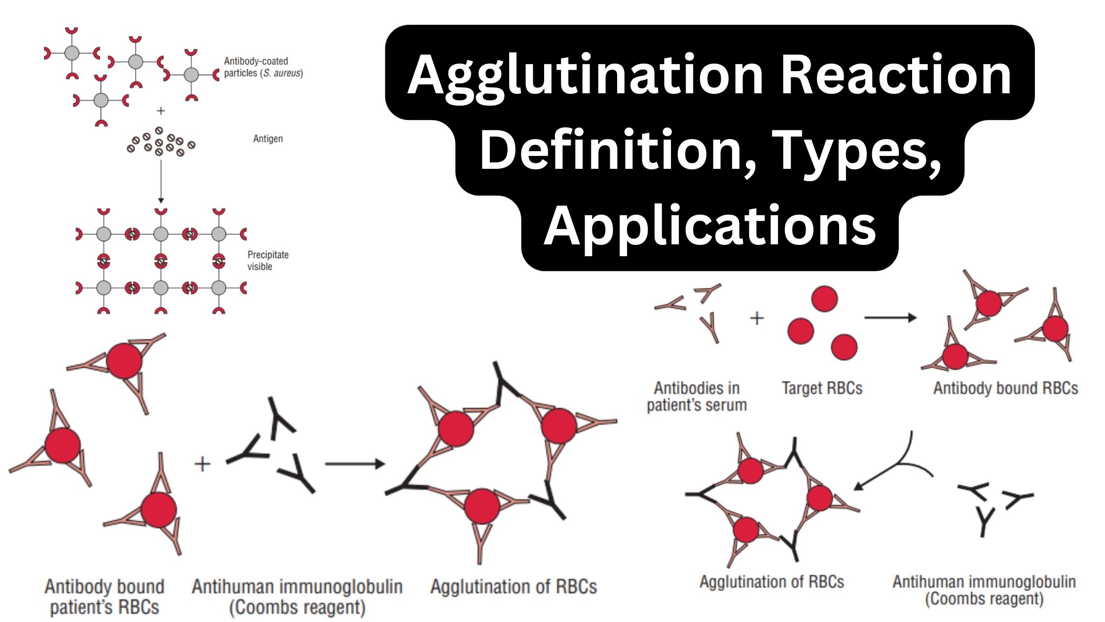 Agglutination Reaction Definition, Types, Applications