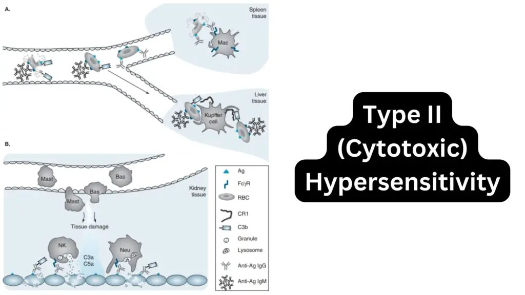 Type II (Cytotoxic) Hypersensitivity