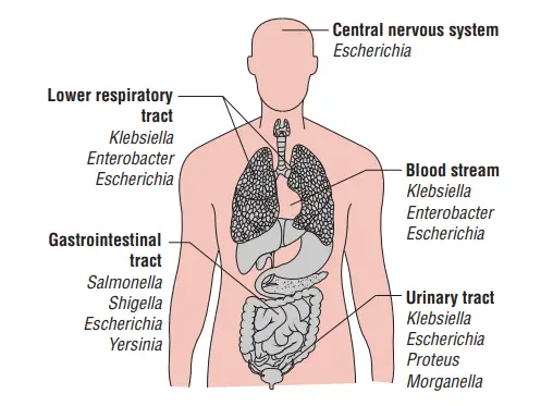 Schematic diagram showing variety of diseases caused by
the members of the family Enterobacteriaceae in humans.
