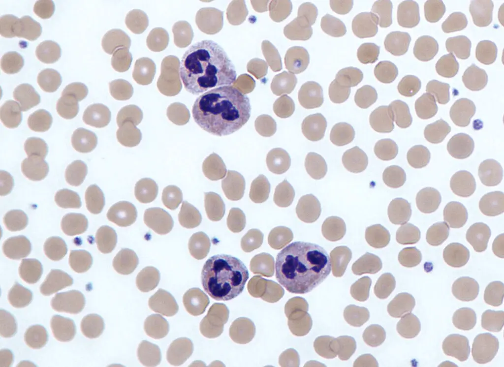 Neutrophils with segmented nuclei surrounded by erythrocytes and platelets. Intra-cellular granules are visible in the cytoplasm (Giemsa stained).
