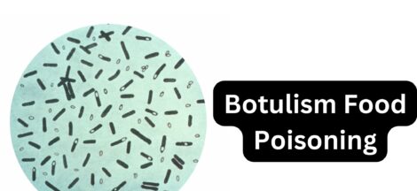 Botulism Food Poisoning