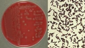 Clostridium perfringens Food Poisoning