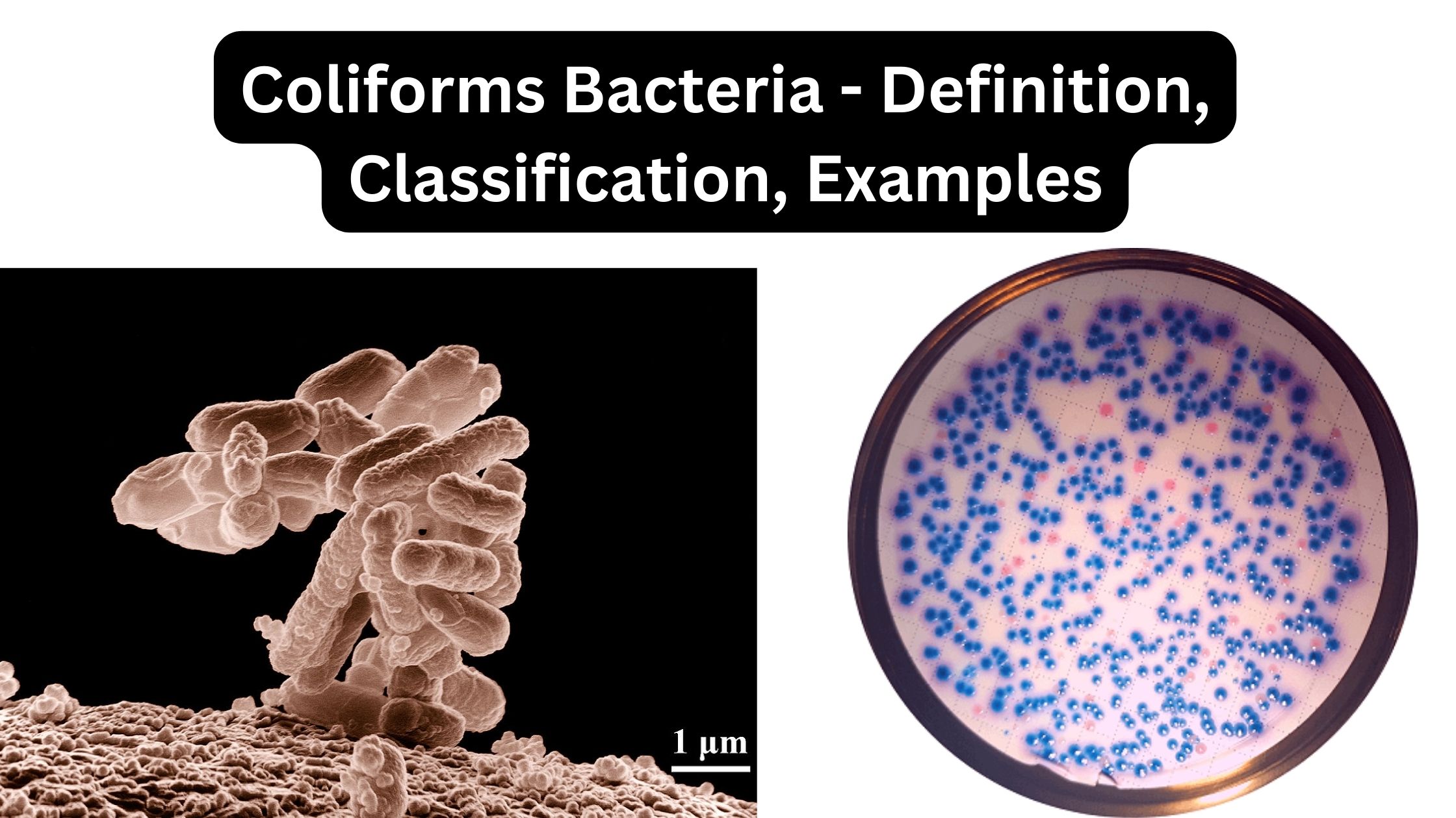 Coliform Bacteria - Definition, Classification, Examples