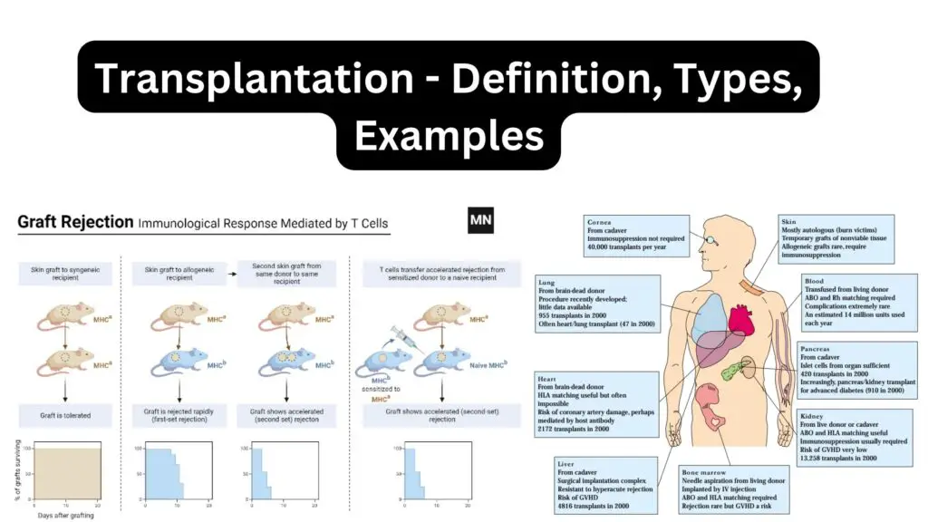 Transplantation - Definition, Types, Examples