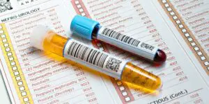 Glucose Tolerance Test - Principle, Procedure, Types, Applications