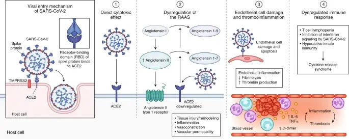 Pathogenesis of SARS-CoV-2 (COVID-19)