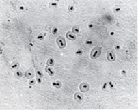 Serotyping of Streptococcus pneumoniae