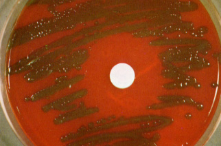 Streptococcus pneumoniae A mucoid strain on blood agar showing alpha hemolysis (green zone surrounding colonies). Note the zone of inhibition around a filter paper disc impregnated with optochin. Viridans streptococci are not inhibited by optochin.  
