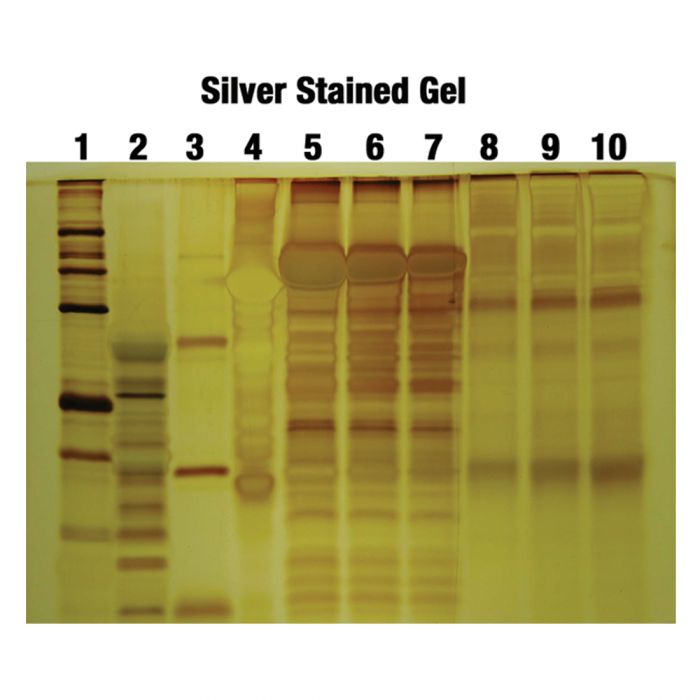 Silver Staining - Principle, Procedure, Applications