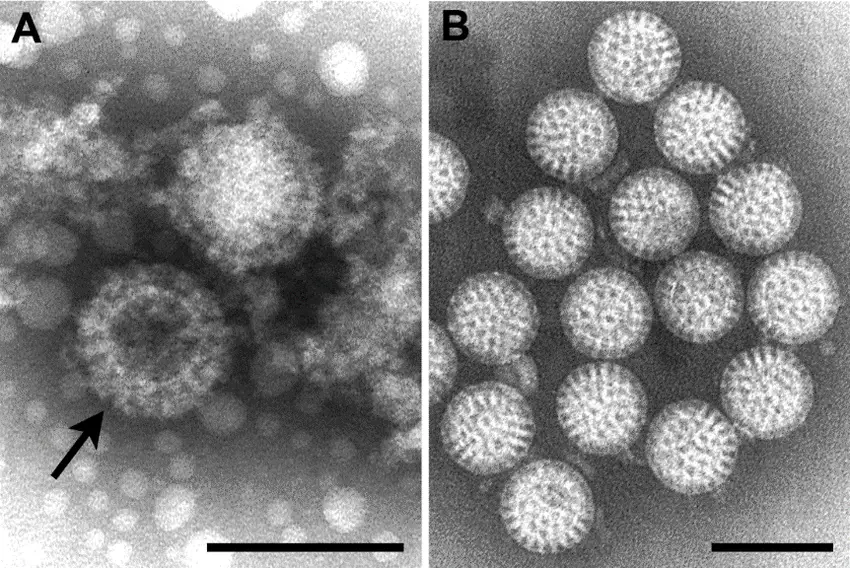 (A) Negative stain EM image of orthoreovirus particles, with a stain-penetrated particle (arrow) showing the double capsid layers; (B) Negative stain EM image of rotavirus particles. Bars, 100 nm. (Figure B, courtesy of Charles D. Humphrey, Centers for Disease Control and Prevention, Atlanta, GA, USA.)  
