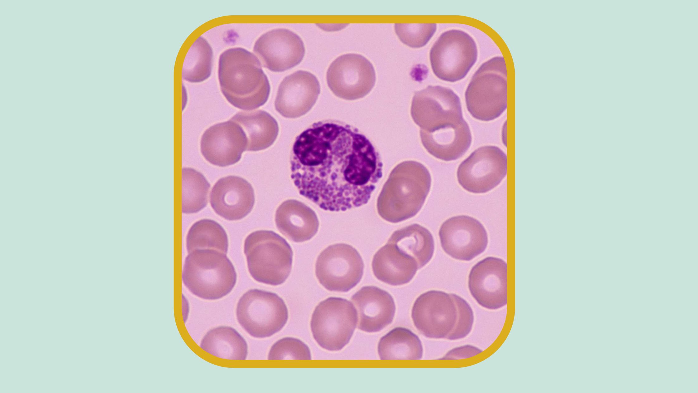 Facts about Eosinophils