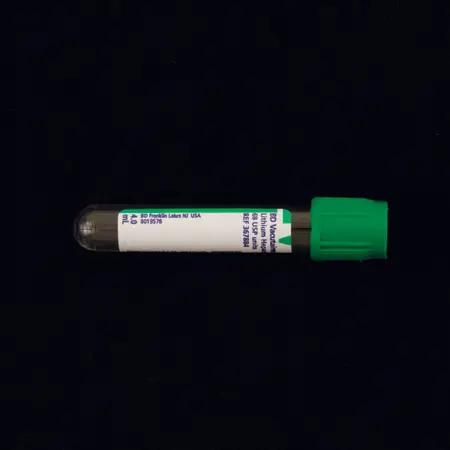 Green (Lithium heparin (light green tube tubes containing lithium heparin and gel for plasma separation) is the additive.)