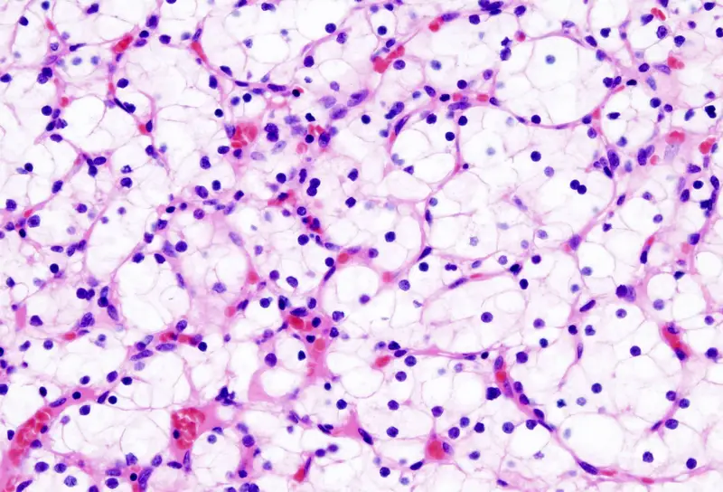 Results and Interpretation of Hematoxylin and Eosin (H&E) Staining