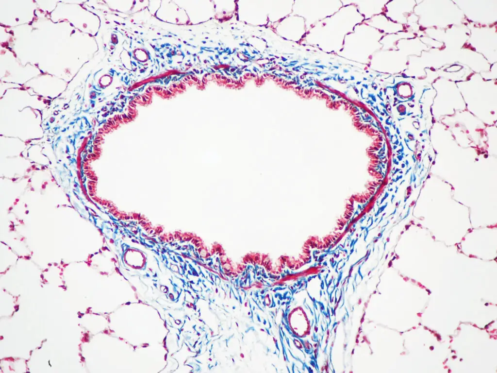Rat airway stained with Masson's trichrome The connective tissue is dyed blue, while the nuclei and cytoplasm are stained dark red/purple and red/pink, respectively.