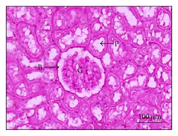 Micrographs of Periodic Acid-Schiff (PAS) staining of rat kidneys. Light microscopies of sagittal half of kidney sections stained with PAS and counterstained with hematoxylin are shown (original magnification 200x for all panels). (a) Normal (ND), (b) normal diet supplemented with CGE (ND + CGE), (c) type 2 diabetes mellitus (DM), and (d) T2DM supplemented with CGE (DM + CGE). Bowman’s capsular spaces are indicated by arrow “B”; the proximal tubular epithelium and the lumen are indicated by arrow “P.” Glomerulus (G).