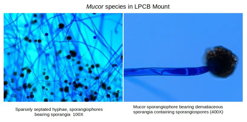 Lactophenol Cotton Blue (LPCB) Mounts
