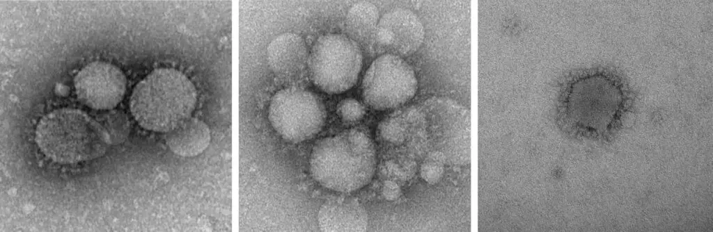 MERS-CoV particles as observed by negative staining EM. (CDC: Cynthia Goldsmith/Azaibi Tamin)
