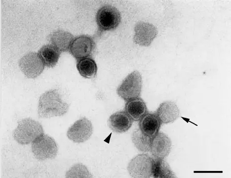 Negative stain of an enveloped virus with such short surface projections that they are not often visible in negative stains (rubella virus); the nucleocapsids inside are not morphologically distinct. Some particles are outlined by the stain, showing the surface of the virus (arrow), and some are penetrated by the stain (arrowhead) allowing visualization of the interior of the virus. Bar, 100 nm. Magnification, ϫ 100,000. (Reprinted from reference 56 with permission of John Wiley & Sons, Inc. Copyright 1986 Wiley-Liss, Inc., a subsidiary of John Wiley & Sons, Inc.) 
