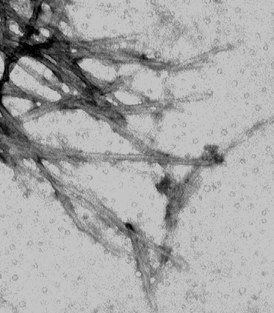 Negative stain of alpha synuclein
