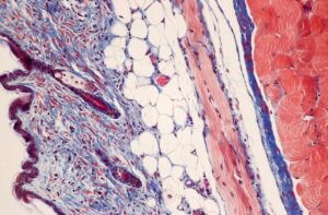 Mouse skin stained with Masson's trichrome stain.