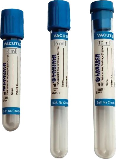 Royal Blue (Plastic tubes is sprayed with K2 EDTA. K2 EDTA increases the MCV (mean corpuscular volume) of RBC in higher concentrations)