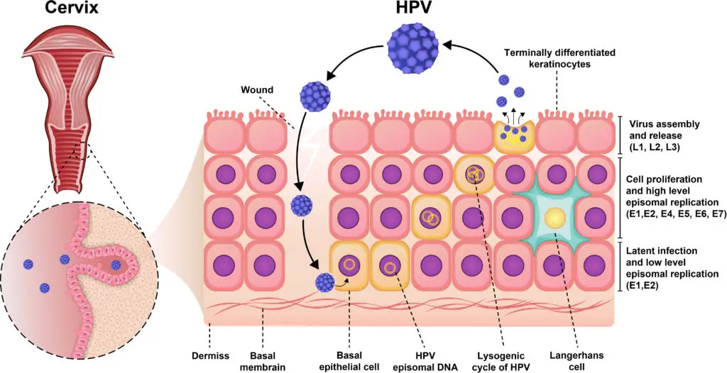 Pathogenesis of Human Papillomavirus (HPV)