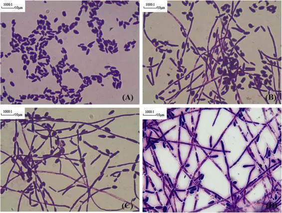  Four classes of morphologic change in hyphae formation of C. tropicalis. 5 × 106 C. tropicalis cells (20 μl) were inoculated in RPMI 1640 medium supplemented with 10% Fetal Bovine Serum at 37 °C for 12 h. Cells were Gram stained and observed by light microscopy at 100× magnification. A–D represented Class I–IV, respectively.