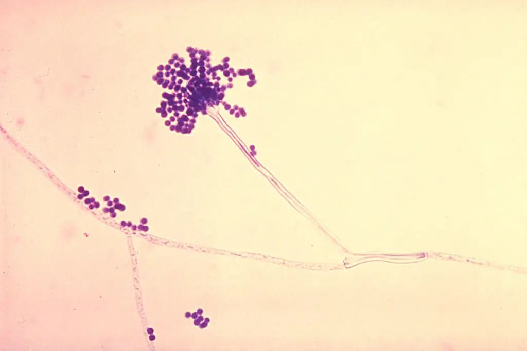 Aspergillus fumigatus Images
