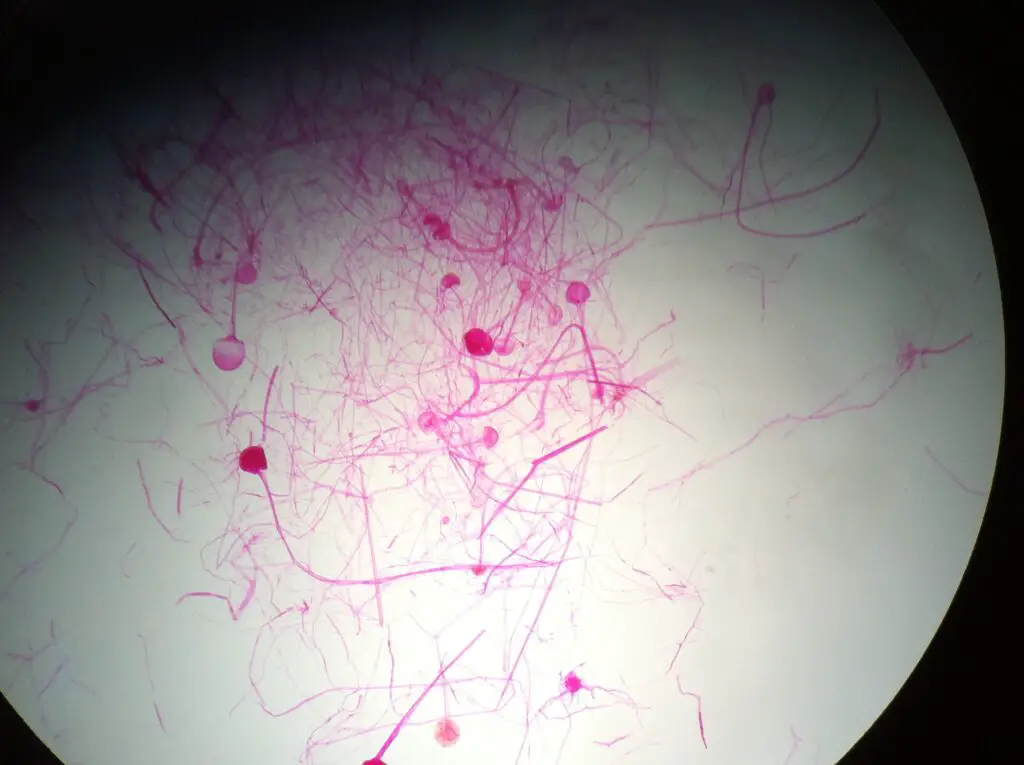 Rhizopus sporangia under microscope