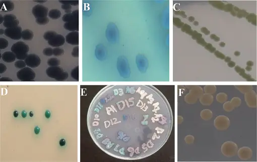 (A) Candida tropicalis bluish purple colonies. (B) The appearance of C. tropicalis after 72 hours of incubation on CHROMagar at 37°C. (C) Apple green color colonies of Candida albicans grown for 48 hours on CHROMagar Candida at 37°C. (D) Isolated green color colonies of C. albicans grown for 48 hours on CHROMagar Candida at 37°C. (E) Direct plating of sample on CHROMagar Candida for 48 hours at 37°C. Mix colonies of different species can also seen on this plate. (F) Smooth pink colonies of Candida glabrata grown for 48 hours on CHROMagar Candida at 37°C.
