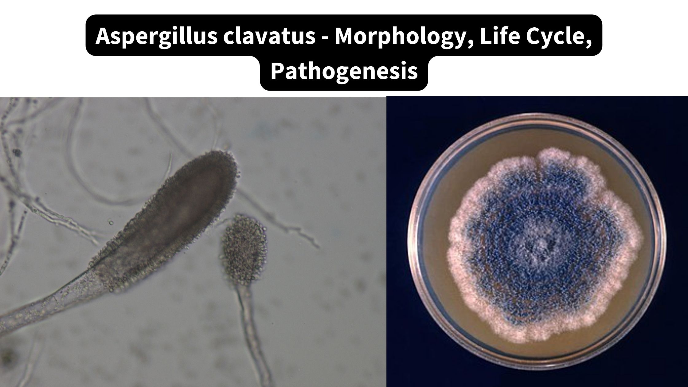 Aspergillus clavatus - Morphology, Life Cycle, Pathogenesis