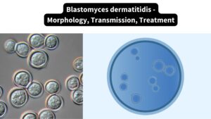 Blastomyces dermatitidis - Morphology, Transmission, Treatment