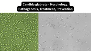 Candida glabrata - Morphology, Pathogenesis, Treatment, Prevention