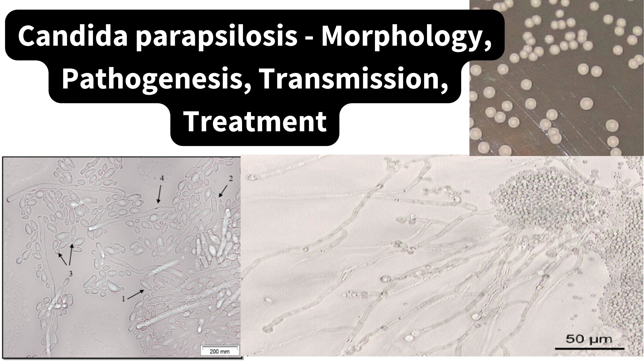 Candida parapsilosis - Morphology, Pathogenesis, Transmission, Treatment