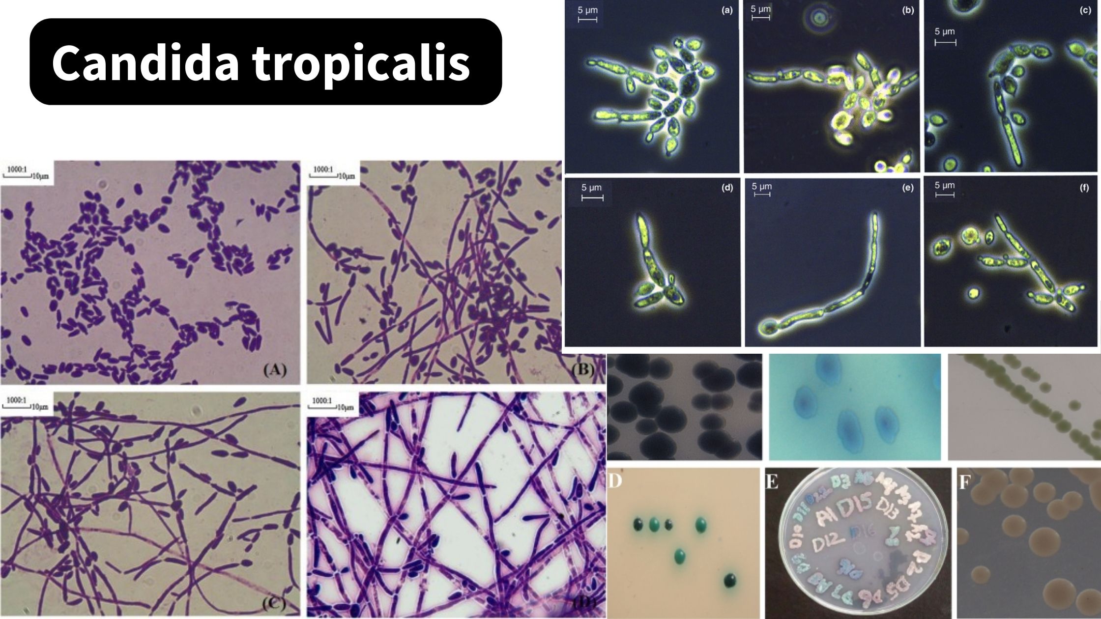 Candida tropicalis - Morphology, Pathogenesis, Transmisssion, Treatment